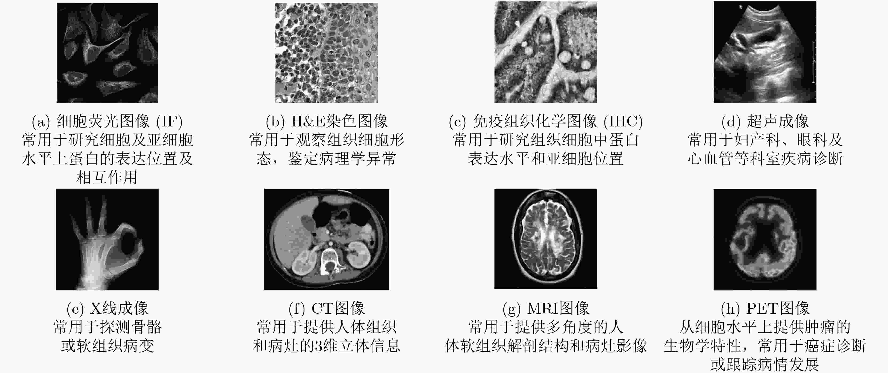 基于模式识别的生物医学图像处理研究现状