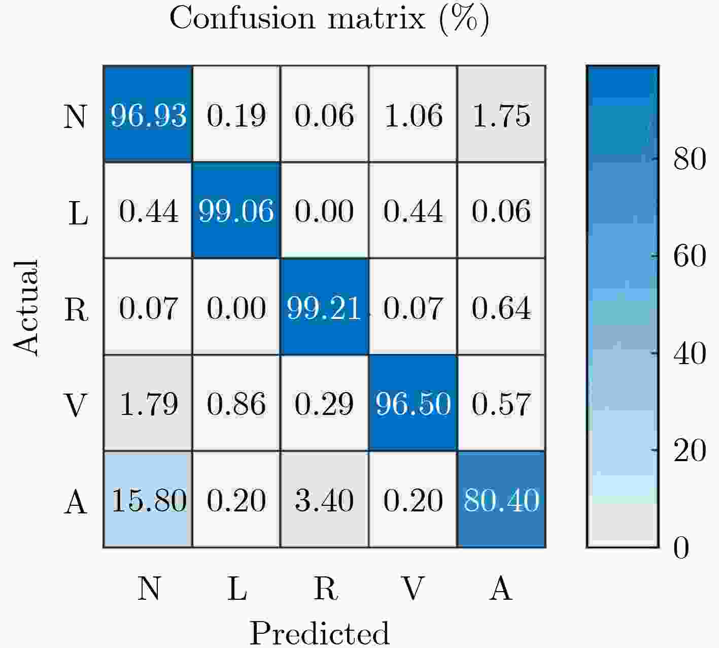 基于小波分解和1D-GoogLeNet的心律失常检测